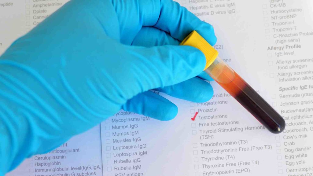 Photograph of blood in a vial measuring testosterone levels - in reference to scientific research on semen retention.